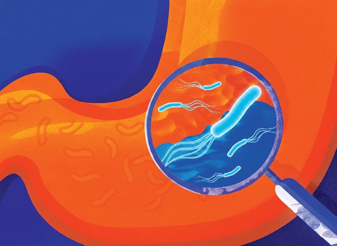 Ключевые положения по микробиологической диагностике Helicobacter pylori