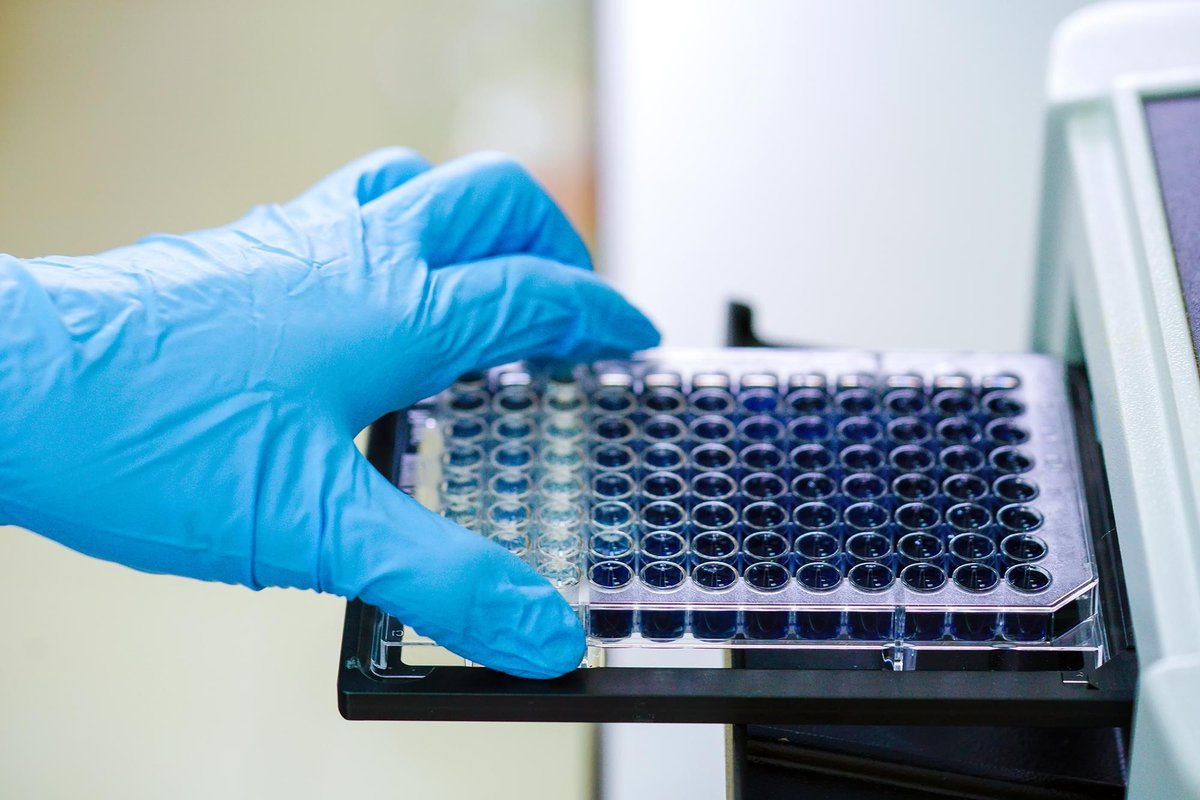 Иммуноферментный анализ (ИФА)