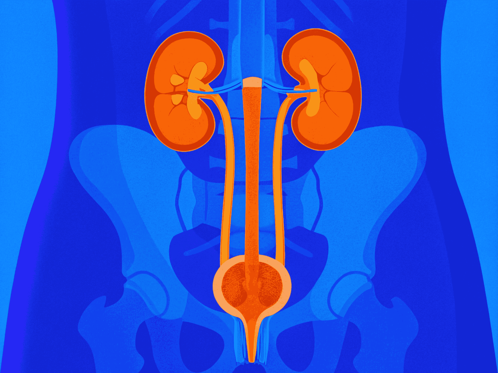 Инфекции мочевыводящих путей