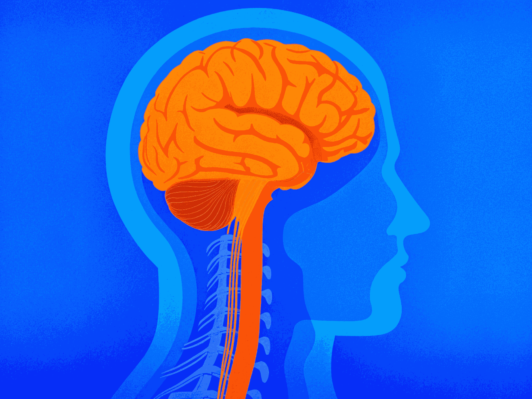 Диагностика менингита