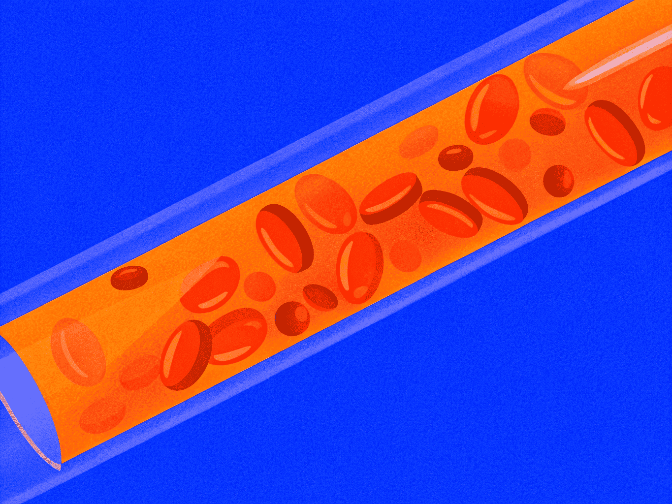 Инфекции кровотока
