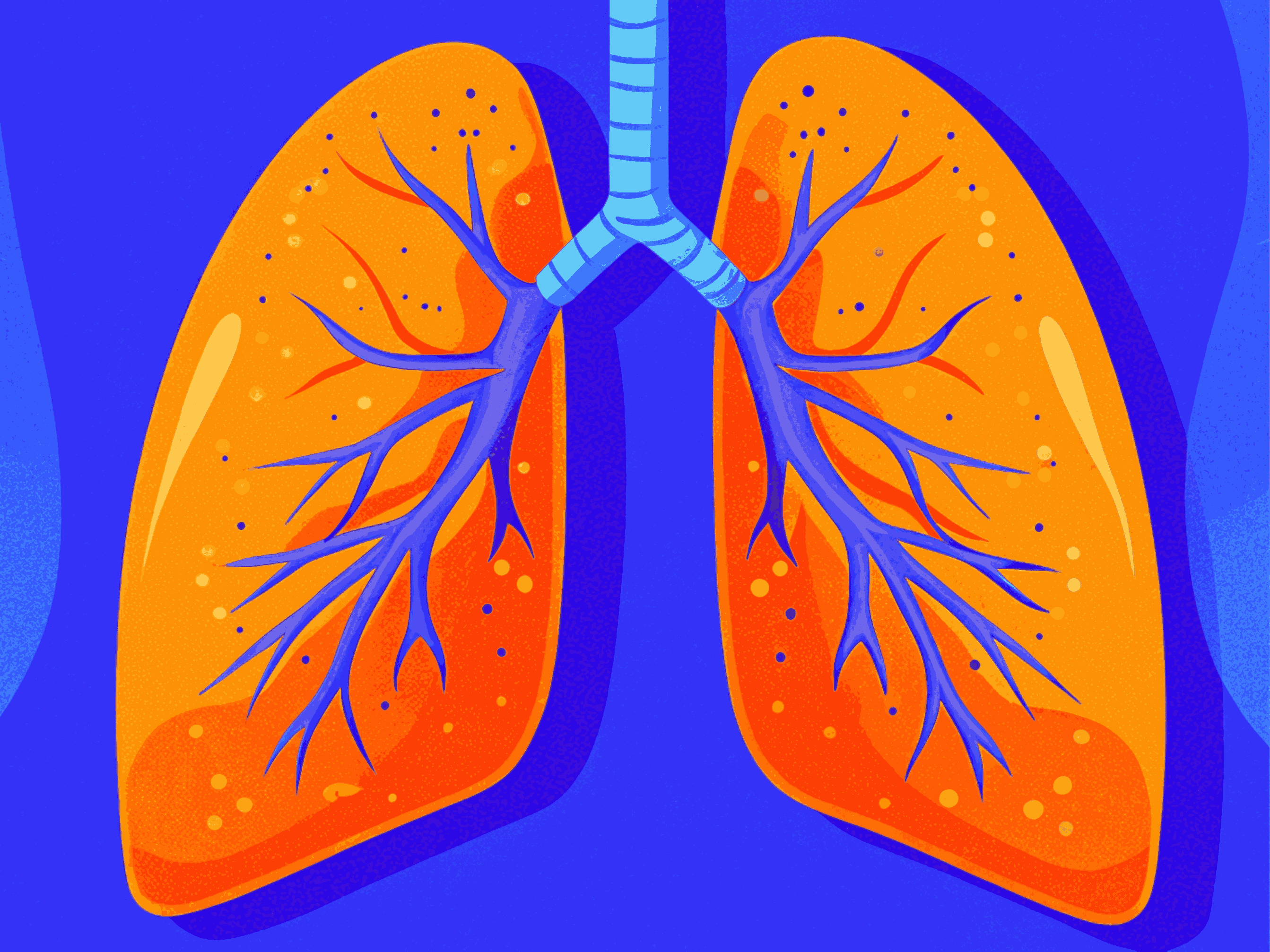 Острые респираторные инфекции