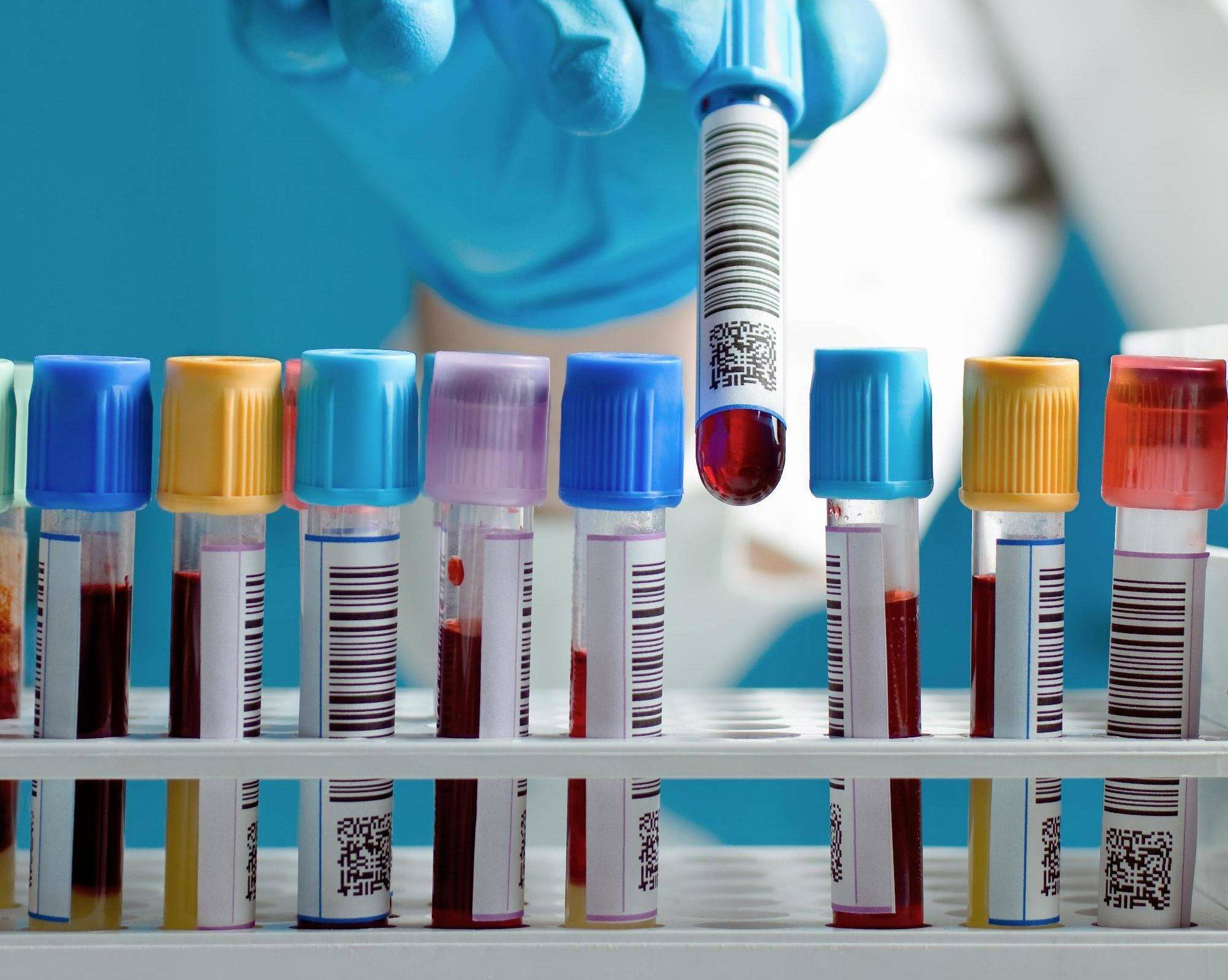 Прокальцитонин: to be or not to be?